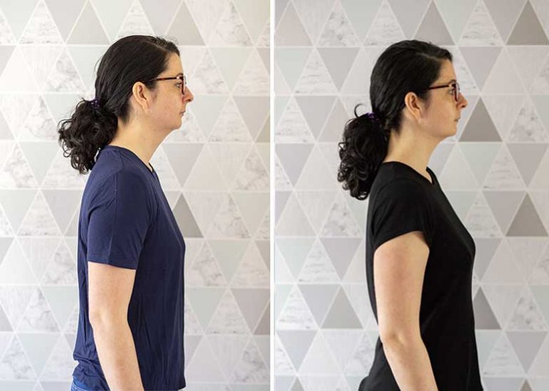 Left: Photo of Donna before she began wearing the Active Posture shirt 2.0. Her neck is pushed forward and shoulders rounded. Right: after wearing the shirt for a few weeks, Donna stands with her shoulders back and neck straighter.
